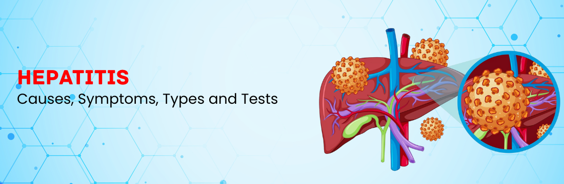 Hepatitis: What are the Causes, Symptoms, Types and Tests Used for the Detection of Abnormality?